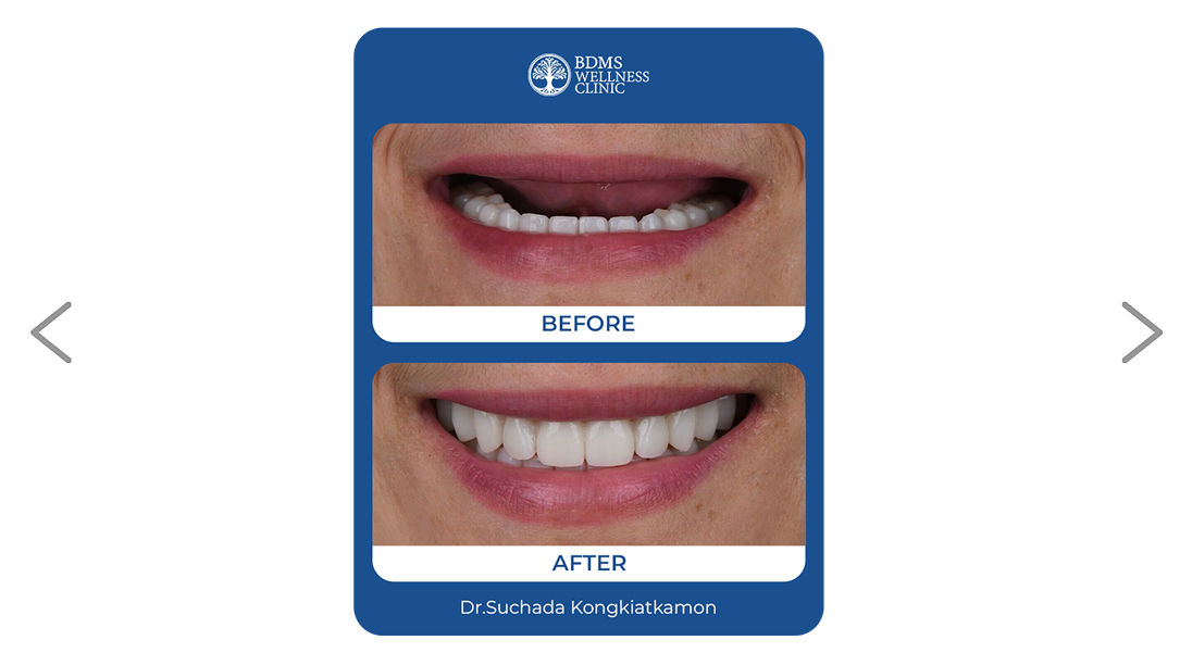 Before and After Case 1